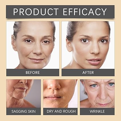 OUHOE Bee Venom Face Cream – Wrinkle Repair & Firming